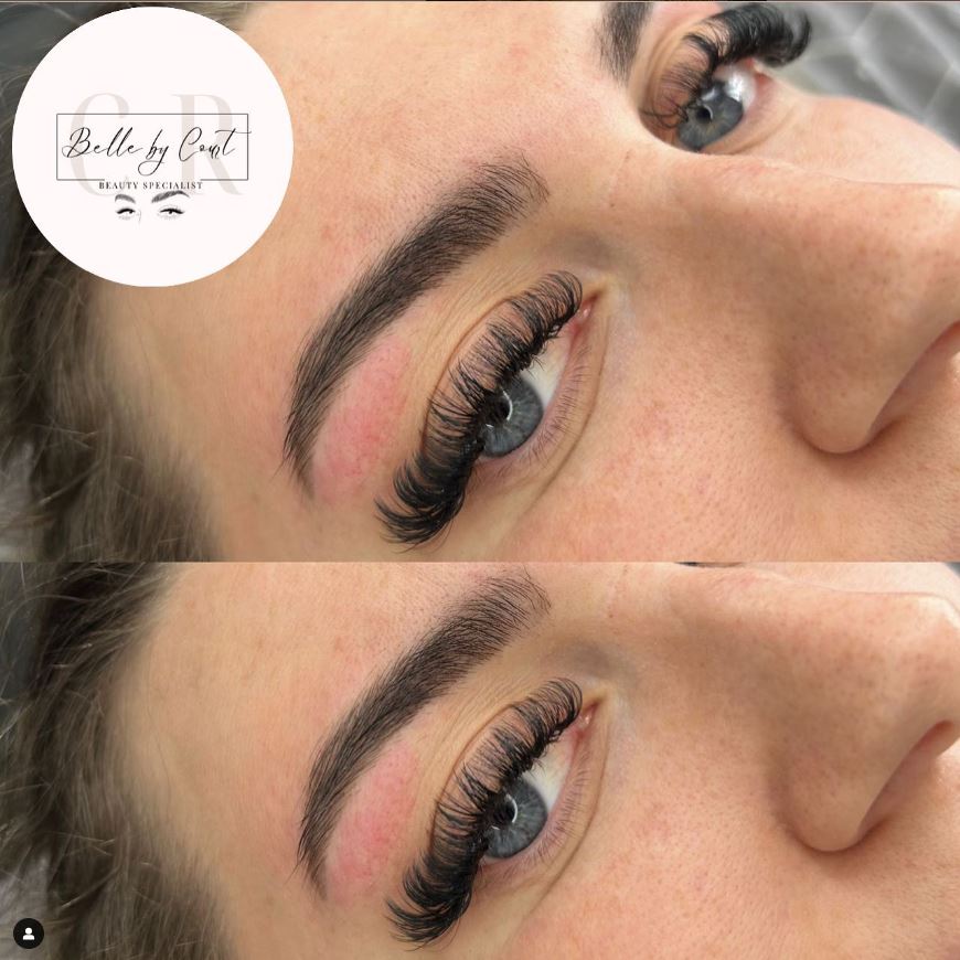 Brow Treatments